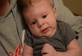 Baby born with brain outside of his skull