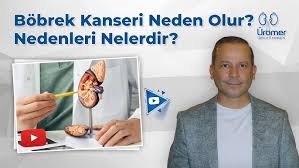 What Causes Kidney Cancer? What are the Causes?