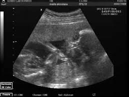 Cambios en tu cuerpo a las 28 semanas de embarazo. Meu Bebe Com 22 Semanas E Tres Dias Youtube