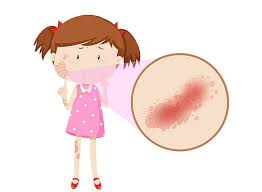 Check spelling or type a new query. Kehamilan Paula Verhoeven Tetap Aman Tak Tertular Walau Kiano Terinfeksi Virus Flu Singapura Semua Halaman Grid Health