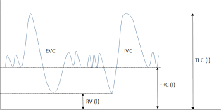 Image result for Vital Capacity