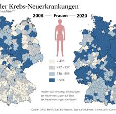 Bauchspeicheldruse Diese Diagnose Ist Ihr Todesurteil Fast Immer Welt