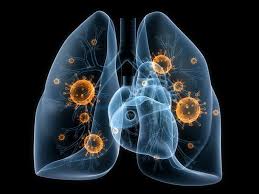 Zum Thema Lungenentzundung Pneumonie Dr Timnik Dr Reiter