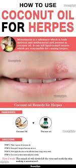 Pin On Home Remedies