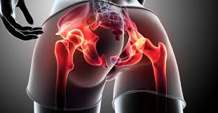 Overall, this muscle type enhances body posture while allowing you to slay deadlifts and squats. The Balance Of Power In The Hips Breaking Muscle