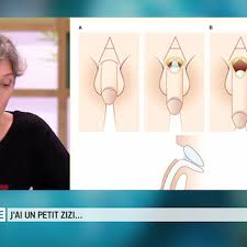 Jai un petit pénis, que faire ?