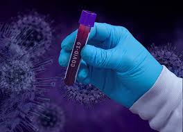 Das coronavirus hat sich auf der ganzen welt ausgebreitet. Coronavirus Schweiz Bag Meldet 2411 Neue Coronavirus Falle Innerh