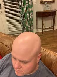 Hair typically grows all over the human body. Laser Hair Removal Update 9 Treatments In Shadow Is Completely Gone Shaved This Morning But It Looks Like This For About 2 Days Before The Remaining Spots Show Bald