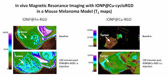 18, 1st floor, lorong chew siik hiong 1a sibu, sarawak, malaysia, 96000. Sub Sessions Pl 03 Anne Rios Utrecht Investigating The Cellular Dynamics Of Antitumour Immunity Using 3d Imaging Awarding Farewell Bo 07 Best Of Vemim Poster Pitches Cancer Imaging Bo 05 Best Of Vemim Poster Pitches Imaging Probes