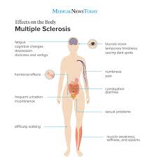 Ms or s the si base unit for time is the second. What Is Multiple Sclerosis And How Can An Exercise Routine Help