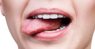 Abnormal cell growth usually appears as the most noticeable signs of tongue cancer are a sore on the tongue that does not heal and a painful tongue. Avoid Mouth Cancer In 2021 Alexandria Smiles
