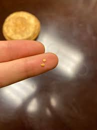 Image result for bed bugs eggs