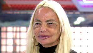 Leticia Sabater, al borde de la muerte: terrible y angustioso accidente,  qué le ha pasado