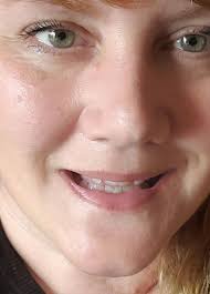 Did you know when you get old, your pubs turn grey too 🙀🙀🙀