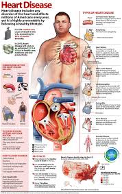 My Job Security Why I Love The South Dear Lord Please Have Them Keep Battering It Deep Frying It Putt Disease Infographic Cardiac Nursing Heart Health