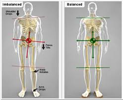 Image result for Functional Leg Length Discrepancy