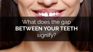 How to fix gap between teeth naturally at home without braces. What Does The Gap Between Your Teeth Signify Youtube