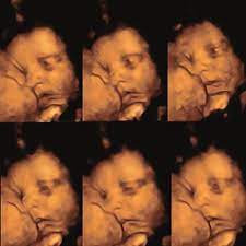 Sequence Of 4d Ultrasound Images The 33 Gestational Week Old Fetus Download Scientific Diagram
