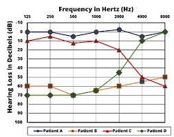 Pure Tone Audiometry In Diagnosing Hearing Loss Practice