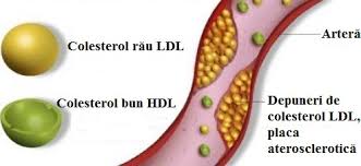 Contribuie la formarea peretilor celulelor, a unor hormoni. Ce InseamnÄƒ Colesterol Ridicat È™i Care Sunt Valorile Cu AdevÄƒrat IngrijorÄƒtoare Pentru SÄƒnÄƒtate Bodygeek