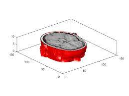 Visualizing Volume Data Matlab Simulink Example Data Volume Visual