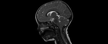 Departamentul de radiologie și imagistică din cadrul spitalului regina maria oferă o gama largă de investigații de înalta performanță având o aparatură nouă, performanță general electric: Am FÄƒcut Un Rmn La ColoanÄƒ Nwradu Blog