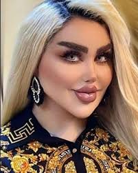 She had 50 operations to look like Angelina Jolie. Wait until you see what  she looked like before. 😮 Check the comments 👇👇👇