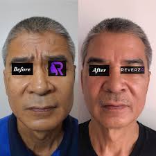 Reverza Aesthetic Medicine