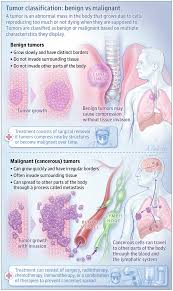 Benign Vs Malignant Tumors In 2020 Medical Knowledge Tumor Craniosacral Therapy