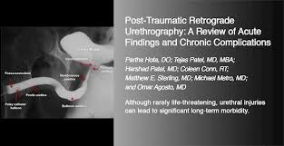 Image result for Retrograde Urethrogram