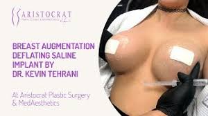 Maybe you would like to learn more about one of these? Breast Augmentation Deflating Saline Implant By Dr Kevin Tehrani Youtube