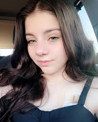 This post has been extremely hard to make & i have been putting it off for  months. As many of you know i had MALS surgery