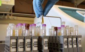 Индийский штамм коронавируса уже обнаружили в сша пока учёные заняты разгадкой секрета новой мутации, миллионы людей могут и не подозревать, что заражены. V Ssha Vyyavili Indijskij Shtamm Koronavirusa S Dvojnoj Mutaciej Obshestvo Rbk