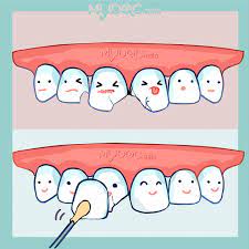 Klinik pergigian salak is a dental clinic in salak, selangor that serves your dental needs at a very affordable fee! 53 Rumah Sakit Klinik Dokter Veneer Gigi Terbaik Di Kuala Lumpur