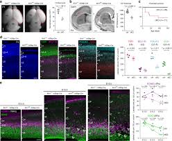 These are errors intended to help the programmer incorporate flexlm in their product, and should be fixed before shipping. Robust Elimination Of Genome Damaged Cells Safeguards Against Brain Somatic Aneuploidy Following Knl1 Deletion Nature Communications