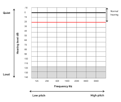 What Is A Hearing Test Hearing Link