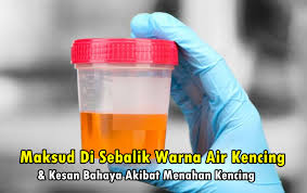 Warna kuning jernih / kuning terang. Maksud Di Sebalik Warna Air Kencing Kesan Bahaya Akibat Menahan Kencing Terlalu Lama