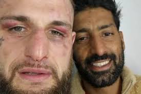 Boxing: Liam Cameron beaten