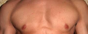 How to know if you have breast cancer male or female. Breast Cancer Awareness Everything Pr News