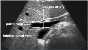 The Radiology Assistant Normal Values Ultrasound