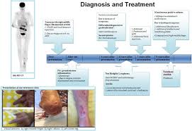 We did not find results for: Dissemination Of Localized Mycobacterium Malmoense Infection In An Immunocompromised Patient International Journal Of Infectious Diseases
