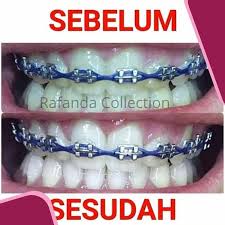Jual Whitening Pasta Gigi Pemutih Herbal Ramuan Herbal Pemutih Gigi Jakarta Pusat Jual Beli Online Bersama Tokopedia
