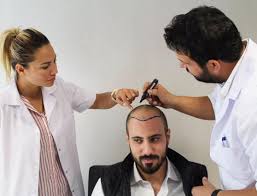 أفضل إبر الشعر لعلاج الصلع مدينة الرياض