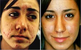 Rachel — VILLANI MEDICAL