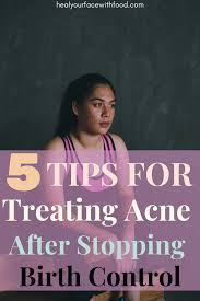 Treat Acne After Stopping Birth Control How To Heal Hormonal Acne Naturally Heal Your Face With Food Stopping Birth Control Hormonal Acne How To Treat Acne