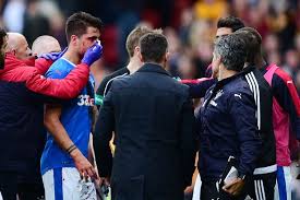 Game log, goals, assists, played minutes, completed passes and shots. Rangers Star Fabio Cardoso Sports Brutal Facial Injury After Having Nose Smashed Twice By Ryan Bowman S Elbow Mirror Online
