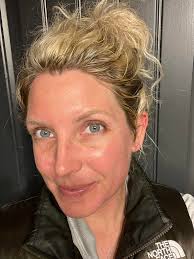 How Pomifera has changed my skin & confidence!