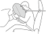 Airbags Injuries