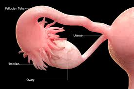 Treatment for stage iii ovarian cancer is the same as for stage ii ovarian cancer: Screening For Ovarian Cancer