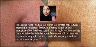 Cobain aja dulu, pasti suka: Stress Liang Pori Macam Kulit Limau Gadis Ini Kongsi Tips Berkesan Kecilkan Pori Pada Wajah Wajib Cuba Siakap Keli News